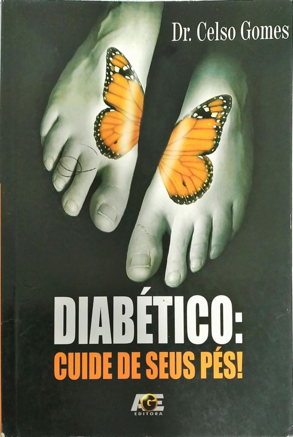 <a href="https://www.touchelivros.com.br/livro/diabetico-cuide-de-seus-pes/">Diabético: Cuide de Seus Pés! - Dr. Celso Gomes</a>