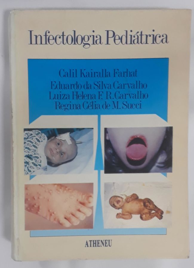 <a href="https://www.touchelivros.com.br/livro/infectologia-pediatrica/">Infectologia Pediátrica - Vários Autores</a>